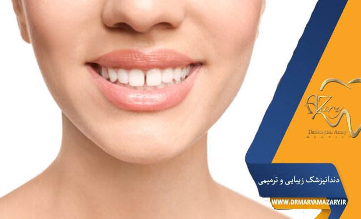 بستن دیاستم و فضای بیین دندانی