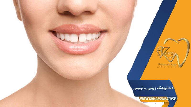 بستن دیاستم و فضای بیین دندانی