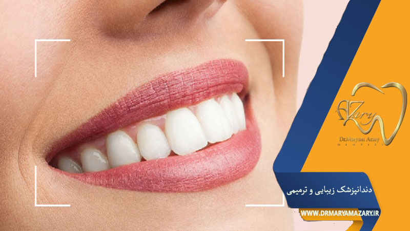 اصلاح طرح لبخند اصفهان