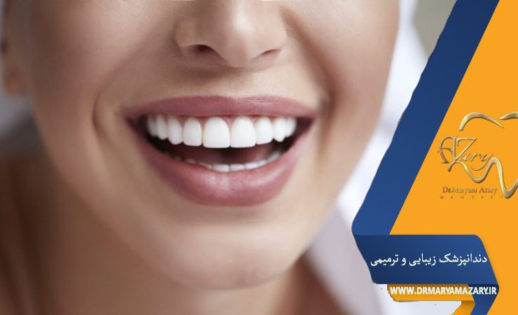 روکش های زیبایی دندان اصفهان