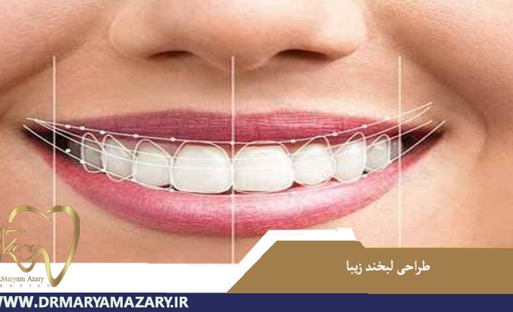 طراحی لبخند زیبا