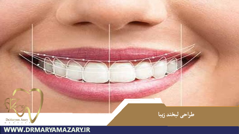 طراحی لبخند زیبا