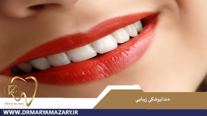 دندانپزشکی زیبایی در اصفهان