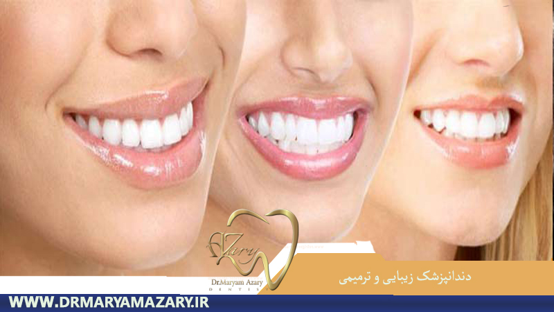 دندانپزشکی زیبایی