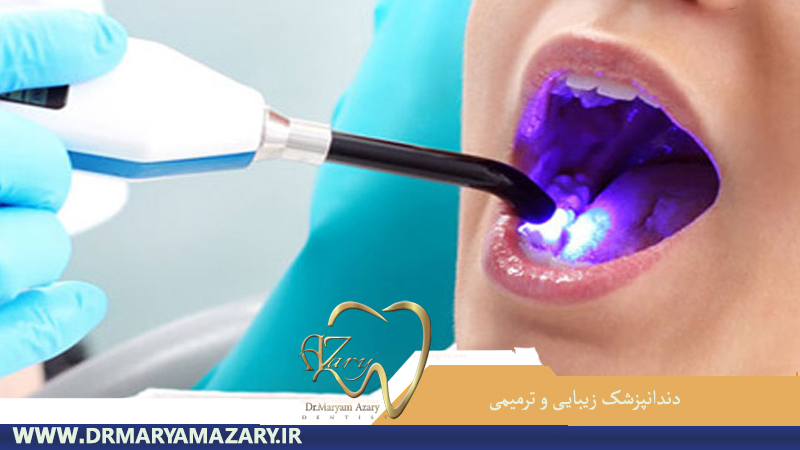 سفید کردن دندان در اصفهان