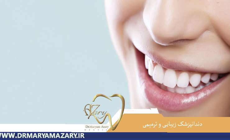 سفید کردن دندان
