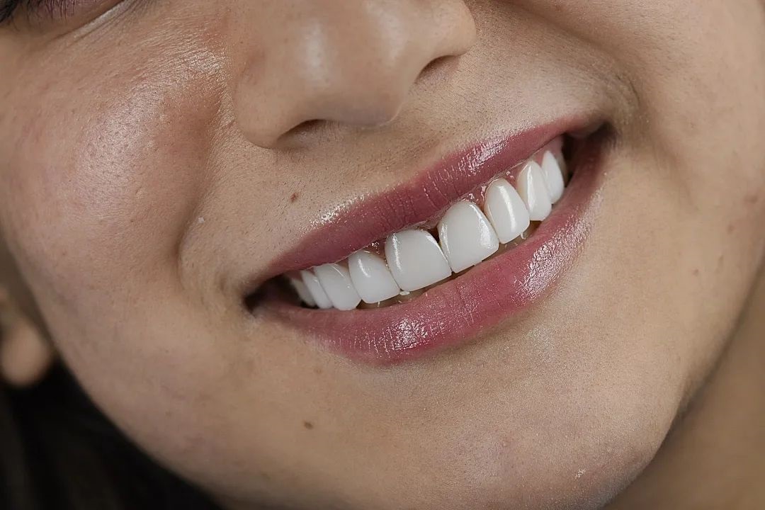 دکتر مریم آذری | تریمیم زیبایی دندان اصفهان