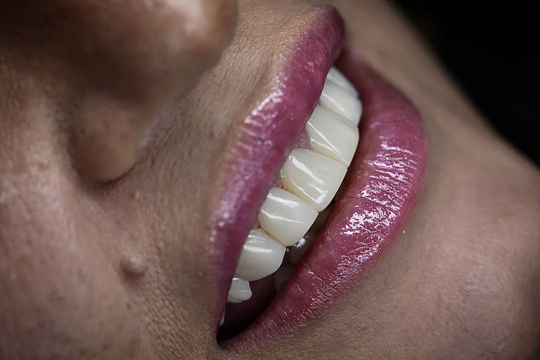 دکتر مریم آذری | بهترین دندانپزشک زیبایی اصفهان