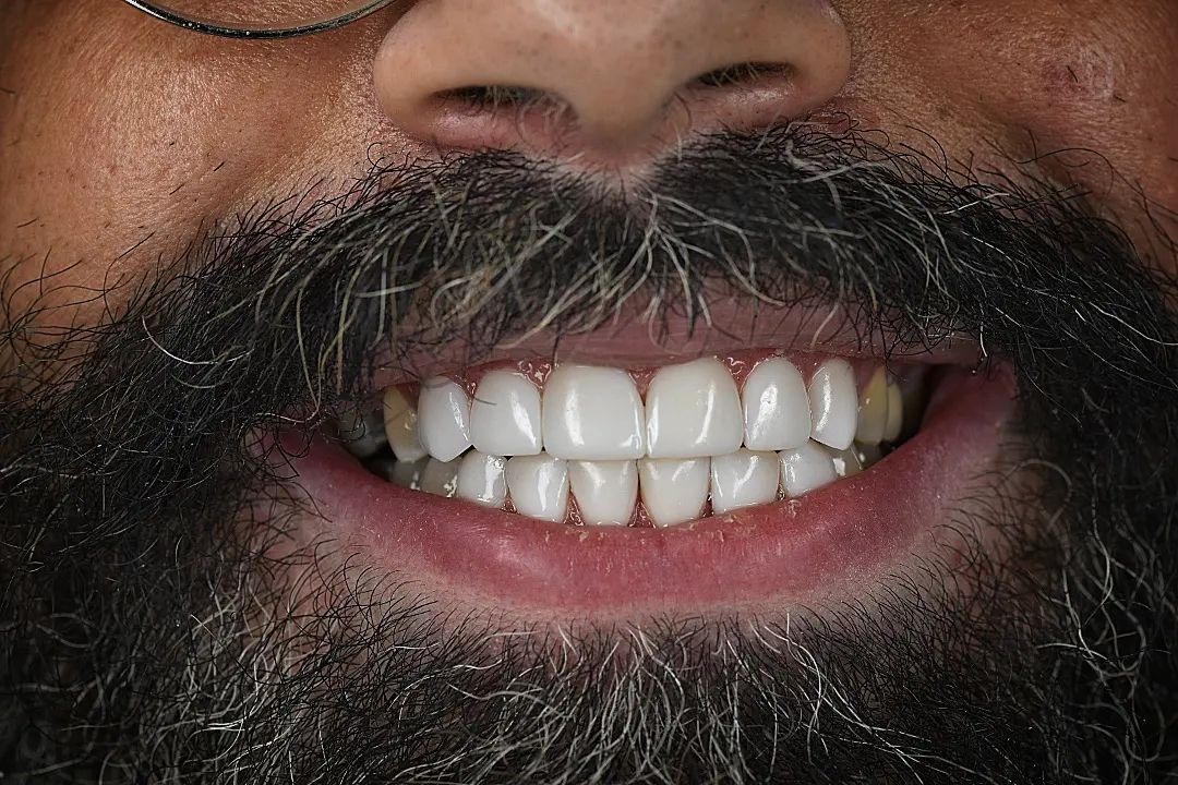 دندانپزشک زیبایی اصفهان