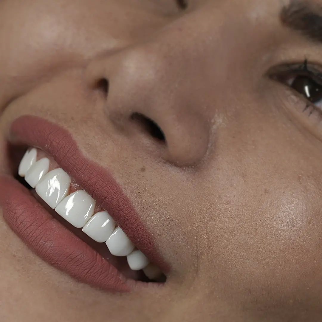 دکتر مریم آذری | خدمات زیبایی دندان