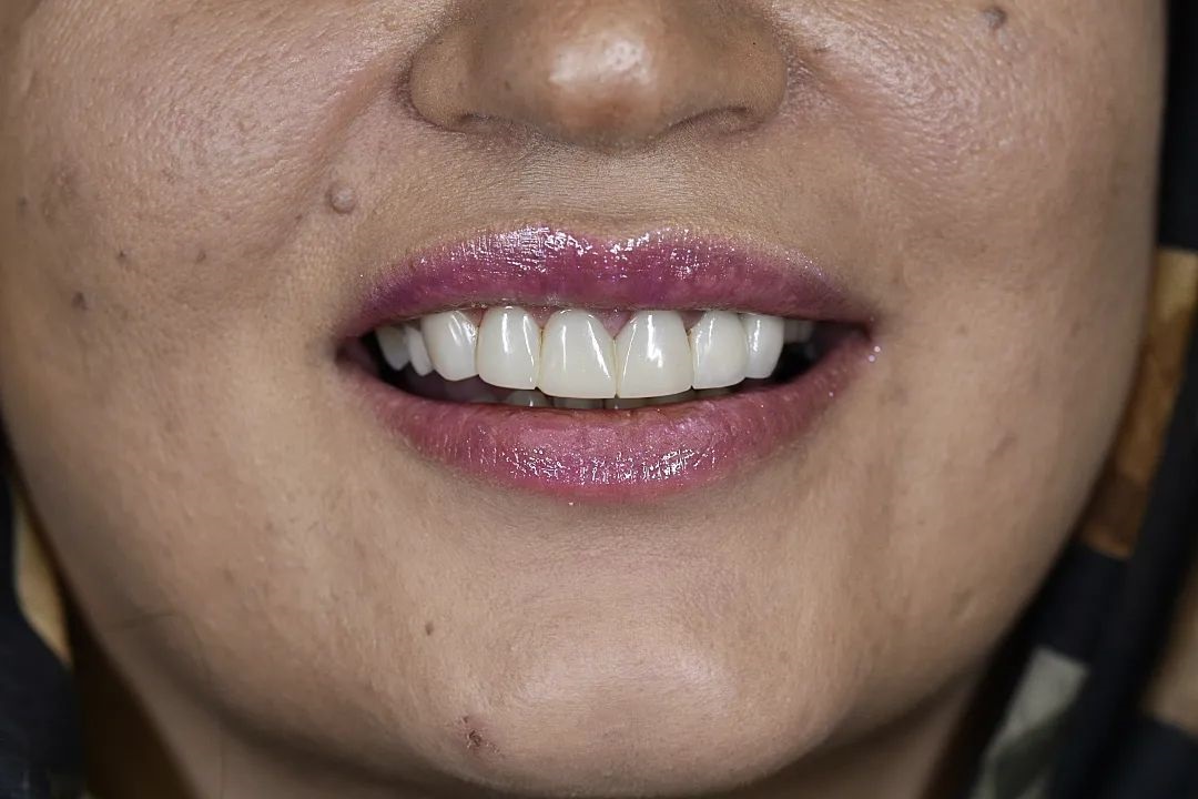 نمونه کار دکتر مریم آذری