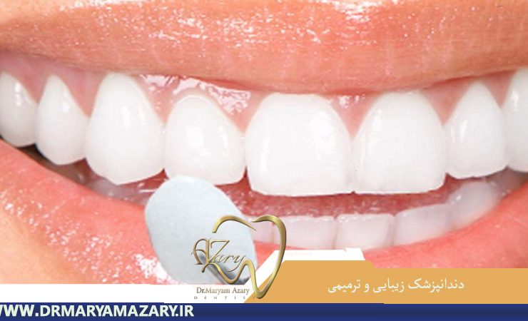 دندانپزشک-زیبایی-ترمیمی-اصفهان | دکتر-مریم-آذری