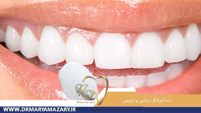 دندانپزشک-زیبایی-ترمیمی-اصفهان | دکتر-مریم-آذری