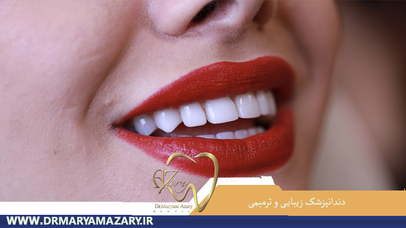 دندانپزشک-زیبایی-ترمیمی-اصفهان | جراح-دندانپزشک-اصفهان