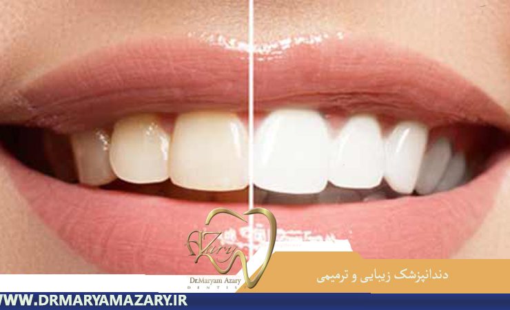 دندانپزشک-زیبایی-ترمیمی-اصفهان | جراح-دندانپزشک-اصفهان