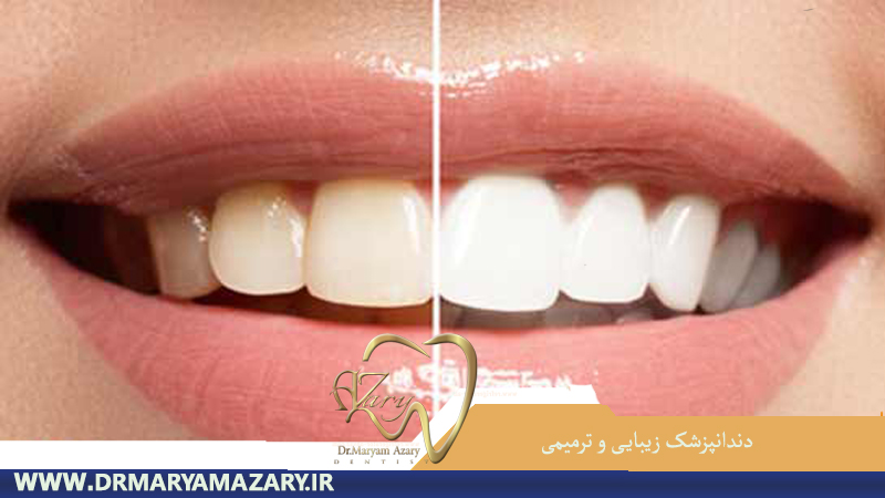 دندانپزشک-زیبایی-ترمیمی-اصفهان | جراح-دندانپزشک-اصفهان