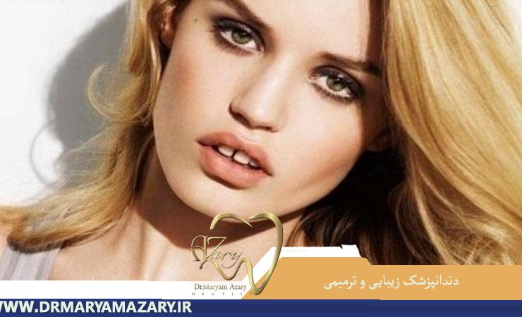 دندانپزشک-زیبایی-ترمیمی-اصفهان | دکتر-مریم-آذری