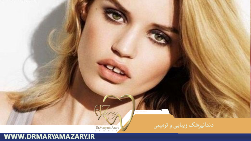 دندانپزشک-زیبایی-ترمیمی-اصفهان | دکتر-مریم-آذری