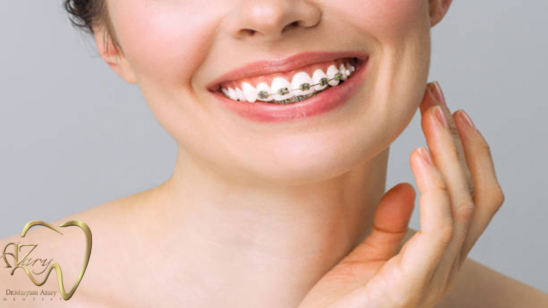 دندانپزشک-زیبایی-ترمیمی-اصفهان | دکتر-مریم-آذری