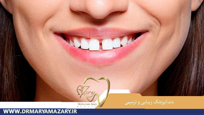 دندانپزشک-زیبایی-ترمیمی-اصفهان | دکتر-مریم-آذری