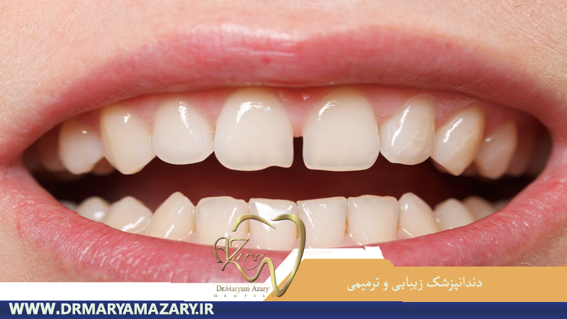 دندانپزشک-زیبایی-ترمیمی-اصفهان | دکتر-مریم-آذری