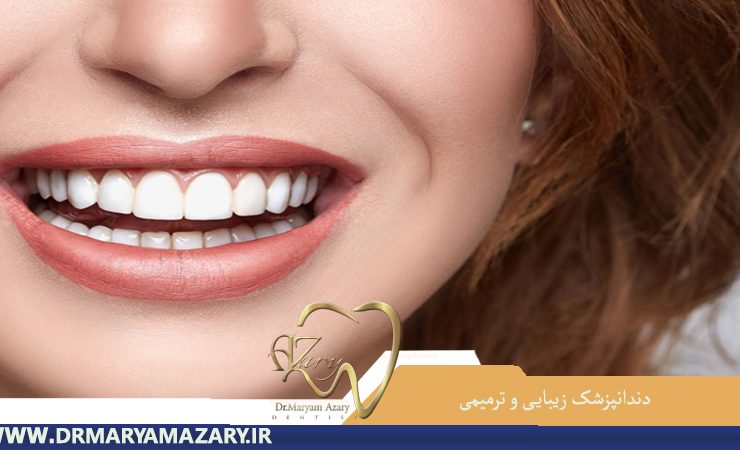 دندانپزشک-زیبایی-ترمیمی-اصفهان | دکتر-مریم-آذری