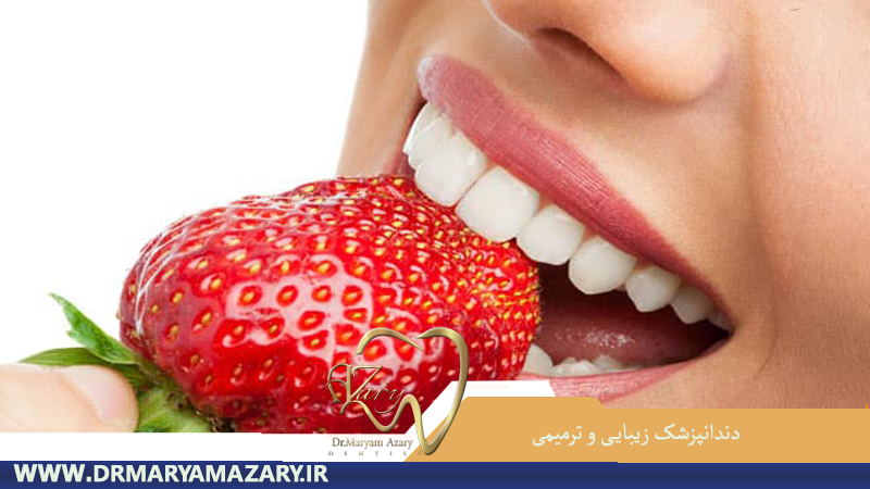 دندانپزشک-زیبایی-ترمیمی-اصفهان | دکتر-مریم-آذری