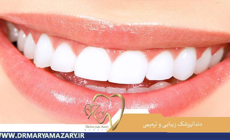 دندانپزشک-زیبایی-ترمیمی-اصفهان | دکتر-مریم-آذری