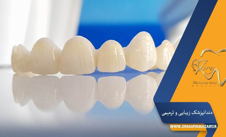 دندانپزشک-زیبایی-ترمیمی-اصفهان | دکتر-مریم-آذری