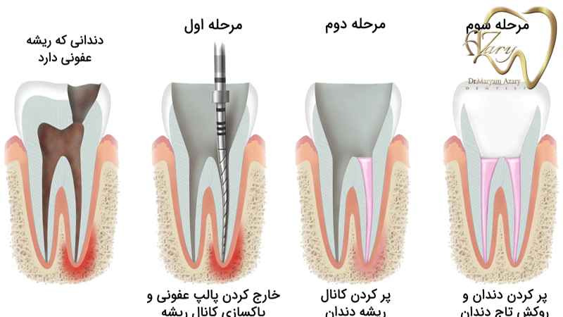 دندانپزشک-زیبایی-ترمیمی-اصفهان | دکتر-مریم-آذری