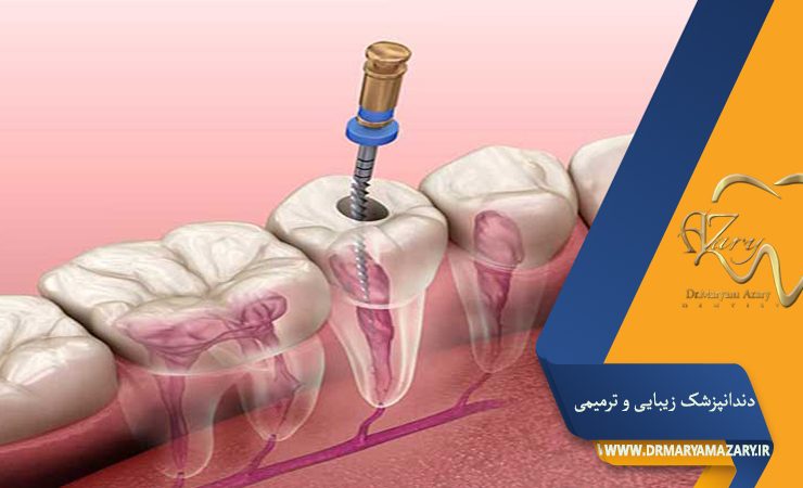 دندانپزشک-زیبایی-ترمیمی-اصفهان | دکتر-مریم-آذری