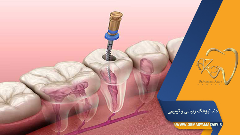 دندانپزشک-زیبایی-ترمیمی-اصفهان | دکتر-مریم-آذری