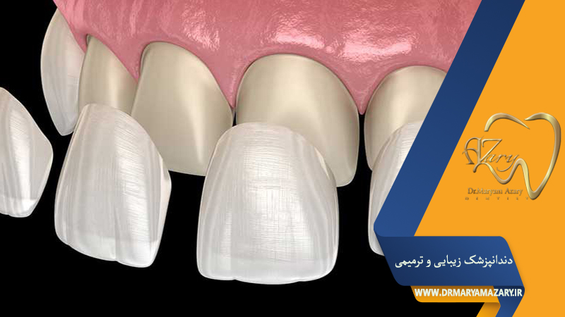 دندانپزشک-زیبایی-ترمیمی-اصفهان | دکتر-مریم-آذری