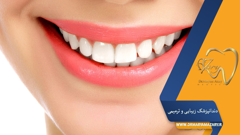 دکتر مربم آذری | جراح دندانپزشک در اصفهان |  دندانپزشک زیبایی ترمیمی اصفهان 