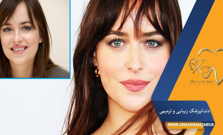 دکتر مربم آذری | جراح دندانپزشک در اصفهان |  دندانپزشک زیبایی ترمیمی اصفهان 