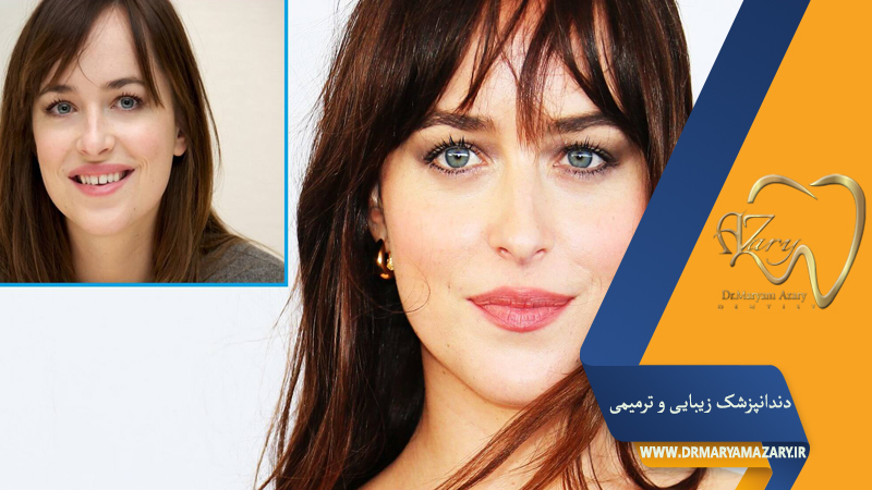 دکتر مربم آذری | جراح دندانپزشک در اصفهان |  دندانپزشک زیبایی ترمیمی اصفهان 