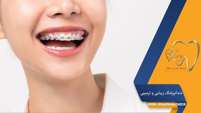 دکتر مربم آذری | جراح دندانپزشک در اصفهان |  دندانپزشک زیبایی ترمیمی اصفهان 