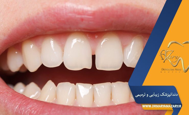 دکتر مربم آذری | جراح دندانپزشک در اصفهان | دندانپزشک زیبایی ترمیمی اصفهان