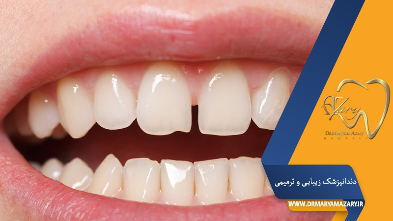 دکتر مربم آذری | جراح دندانپزشک در اصفهان |  دندانپزشک زیبایی ترمیمی اصفهان 