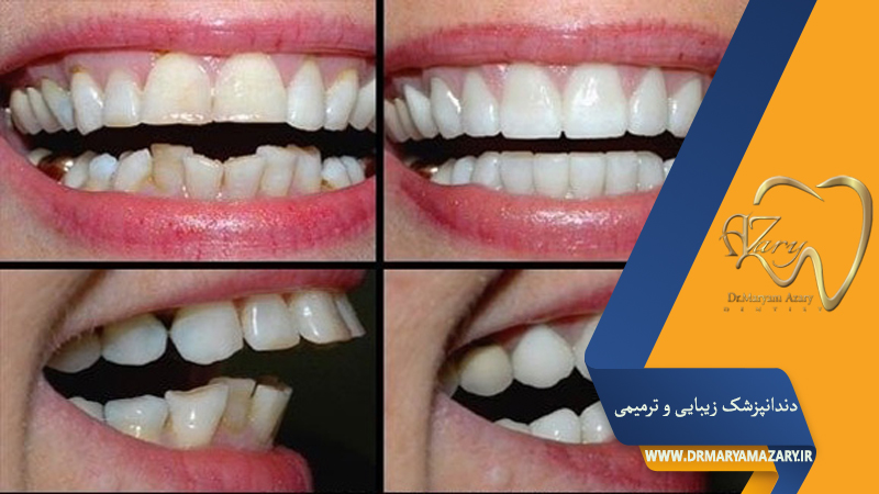 دکتر مربم آذری | جراح دندانپزشک در اصفهان |  دندانپزشک زیبایی ترمیمی اصفهان 