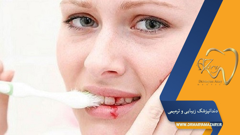 دکتر مربم آذری | جراح دندانپزشک در اصفهان |  دندانپزشک زیبایی ترمیمی اصفهان 