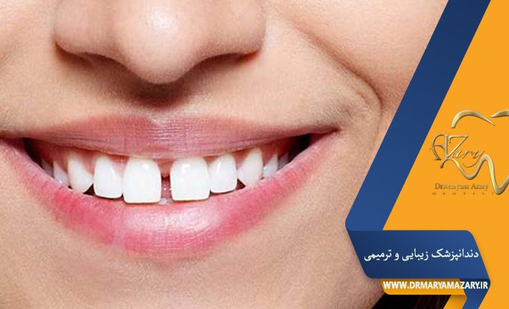 دکتر مربم آذری | جراح دندانپزشک در اصفهان |  دندانپزشک زیبایی ترمیمی اصفهان 