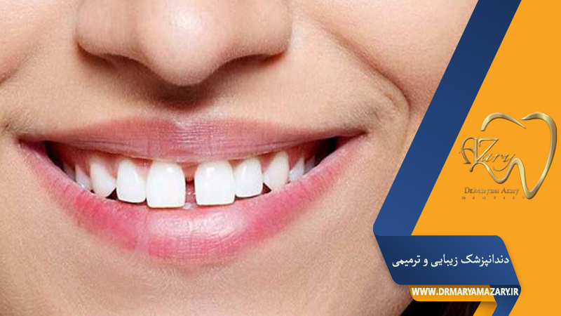 دکتر مربم آذری | جراح دندانپزشک در اصفهان |  دندانپزشک زیبایی ترمیمی اصفهان 