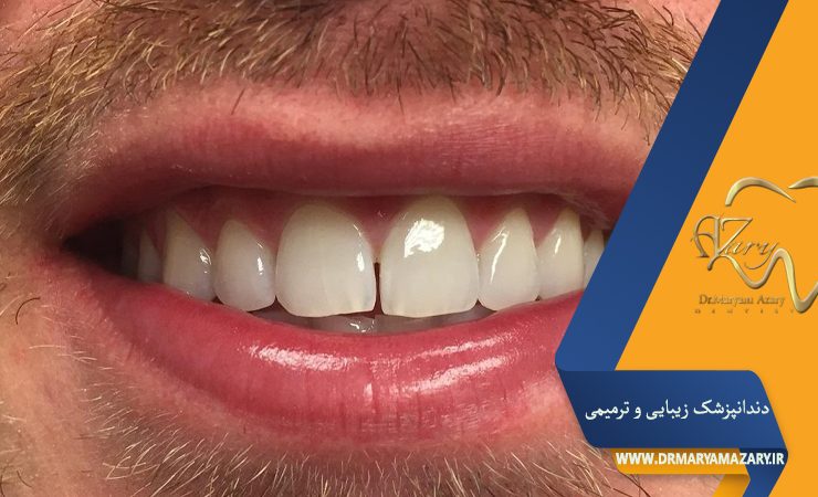 دکتر مربم آذری | جراح دندانپزشک در اصفهان | دندانپزشک زیبایی ترمیمی اصفهان