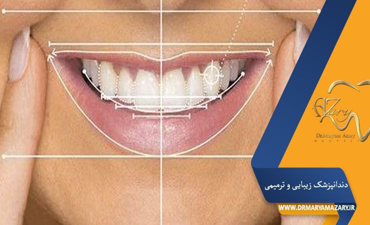 دکتر مربم آذری | جراح دندانپزشک در اصفهان |  دندانپزشک زیبایی ترمیمی اصفهان 