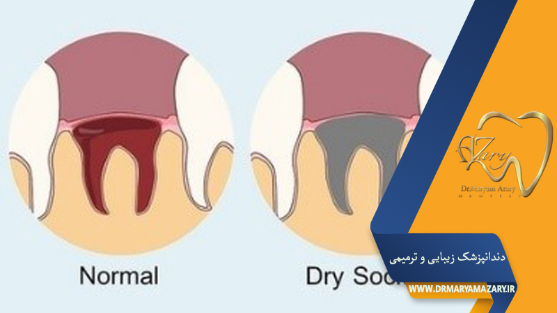 دکتر مربم آذری | جراح دندانپزشک در اصفهان |  دندانپزشک زیبایی ترمیمی اصفهان 