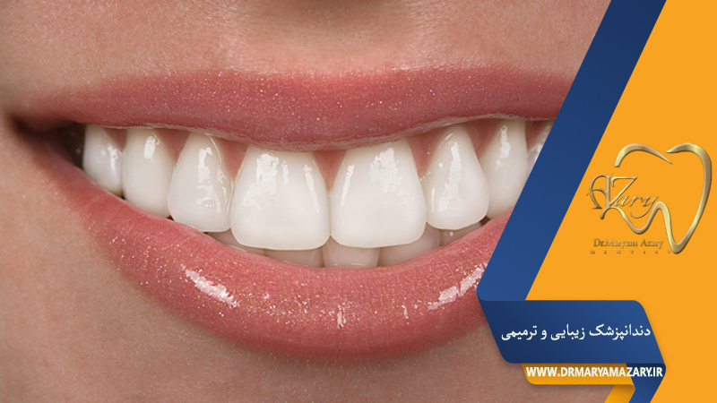 دکتر مربم آذری | جراح دندانپزشک در اصفهان |  دندانپزشک زیبایی ترمیمی اصفهان 