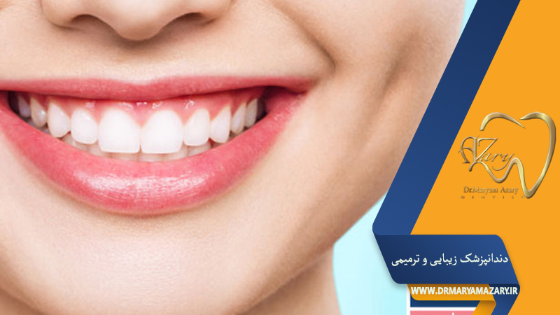 دکتر مربم آذری | جراح دندانپزشک در اصفهان |  دندانپزشک زیبایی ترمیمی اصفهان 