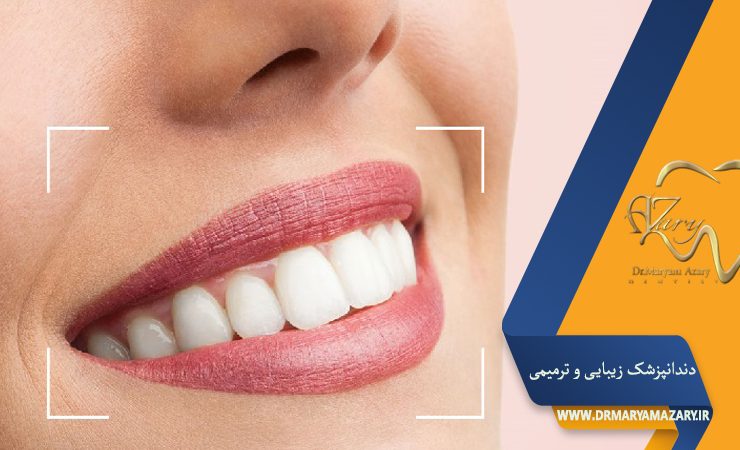 دکتر مربم آذری | جراح دندانپزشک در اصفهان | دندانپزشک زیبایی ترمیمی اصفهان