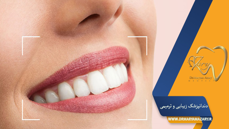 دکتر مربم آذری | جراح دندانپزشک در اصفهان |  دندانپزشک زیبایی ترمیمی اصفهان 